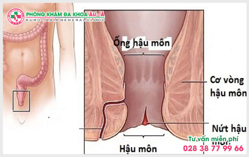 
						Rách hậu môn – Bệnh lý chưa được quan tâm đúng mức