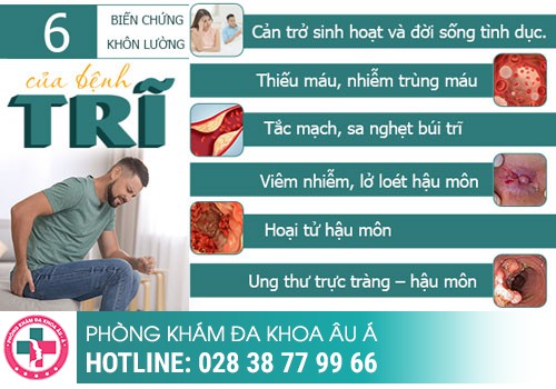 
						Bệnh Trĩ Lâu Năm Có Chữa Được Không?