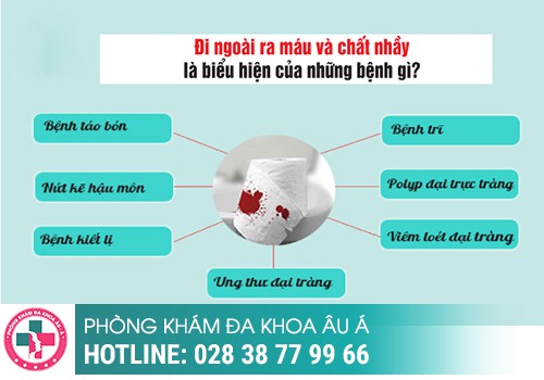 
						Điều Trị Đi Cầu Ra Máu Bất Thường Như Thế Nào