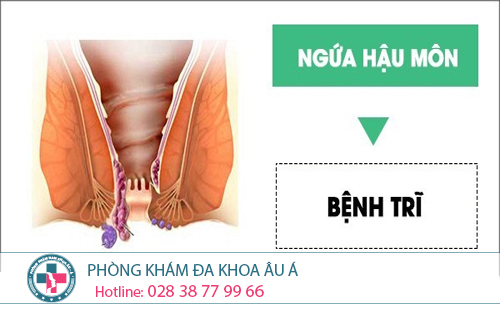 
						Ngứa hậu môn dấu hiệu cảnh báo bệnh lý ở hậu môn – trực tràng