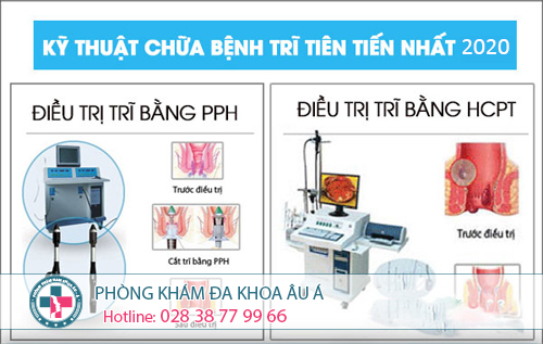 
						Các phương pháp chữa bệnh trĩ hiệu quả