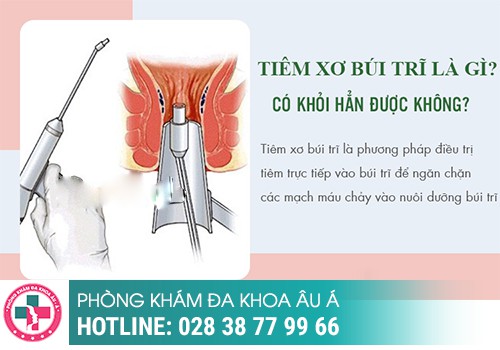 
						Địa Chỉ Làm Teo Búi Trĩ Tốt, Không Cảm Giác, Giảm Triệu Chứng Chỉ Sau 1 Liệu Trình